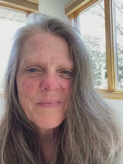 No More Rosacea Struggles!
